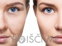 Studio Cryo Beauty, PTUJ