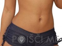 Studio Cryo Beauty, PTUJ