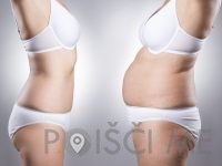 Studio Cryo Beauty, PTUJ