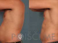 Studio Cryo Beauty, PTUJ