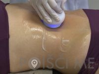 Studio Cryo Beauty, PTUJ1)