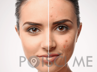 Studio Cryo Beauty, PTUJ
